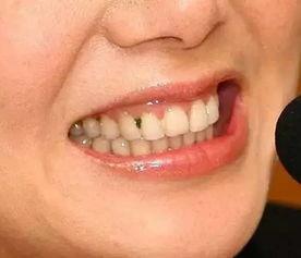 正确刷牙方法视频教程,告别口腔问题